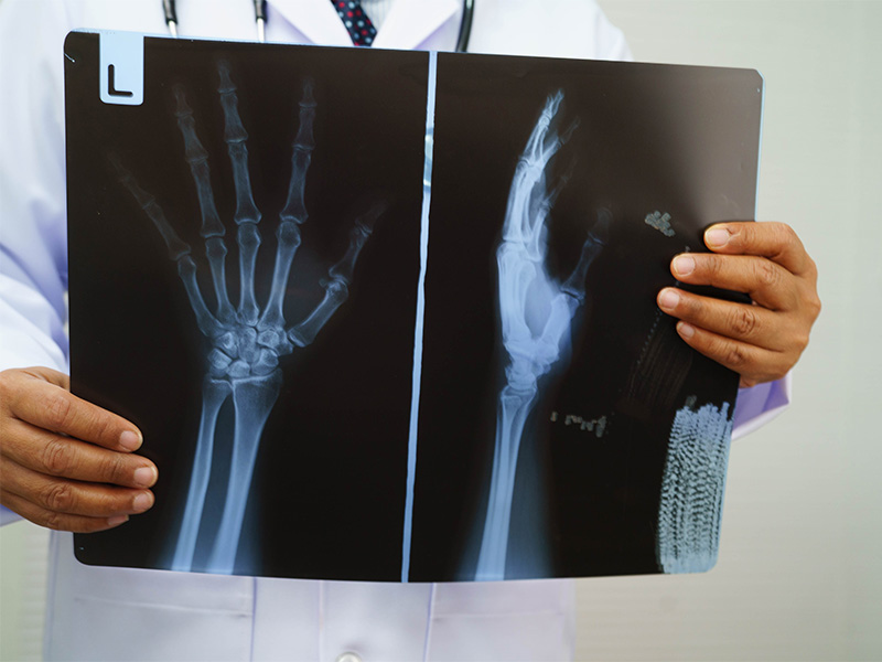Arzt untersucht ein Röntgenbild von Hand und Sprunggelenk zur Diagnose von Knochenstruktur und möglichen Verletzungen in moderner Praxis 