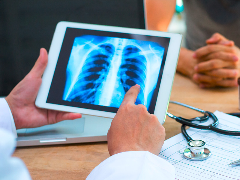 Arzt erklärt älterem Patienten ein Lungenröntgenbild und zeigt Auffälligkeiten zur Diagnose und weiteren Behandlung in moderner Praxis