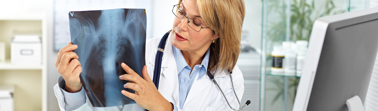 Arzt erklärt älterem Patienten ein Lungenröntgenbild und zeigt Auffälligkeiten zur Diagnose und weiteren Behandlung in moderner Praxis.